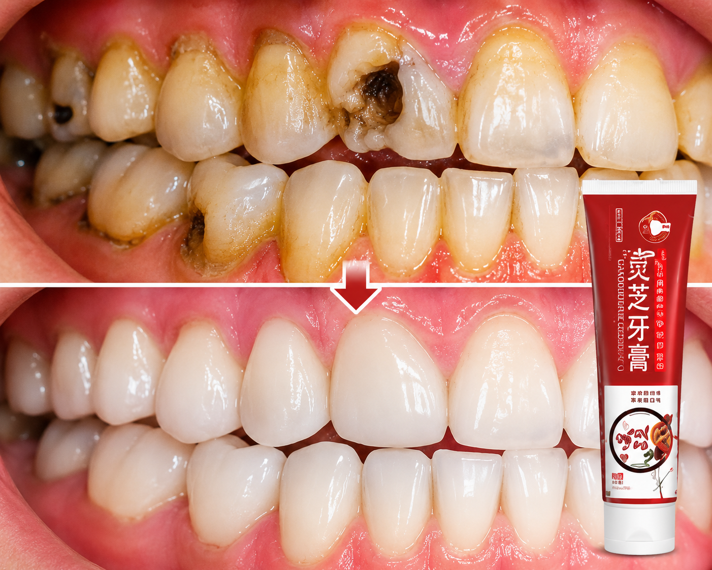Promo Tooth Repair